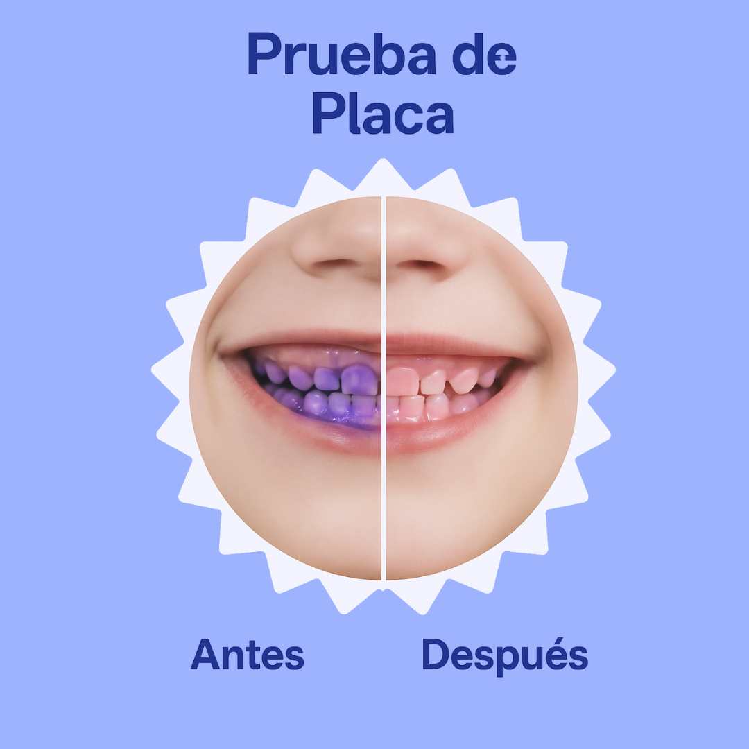 Kiddent Pro Anticaries