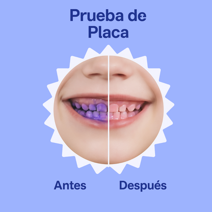 Kiddent Pro Anticaries